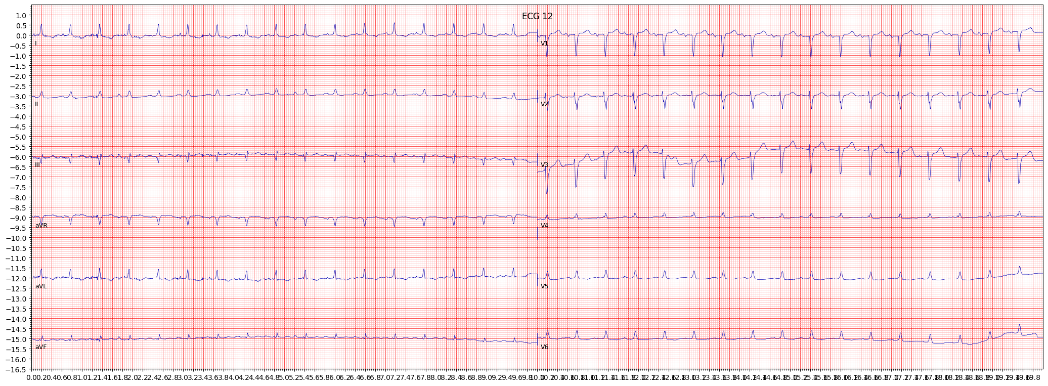 non-specifc ischemic (ISC_) example 1689