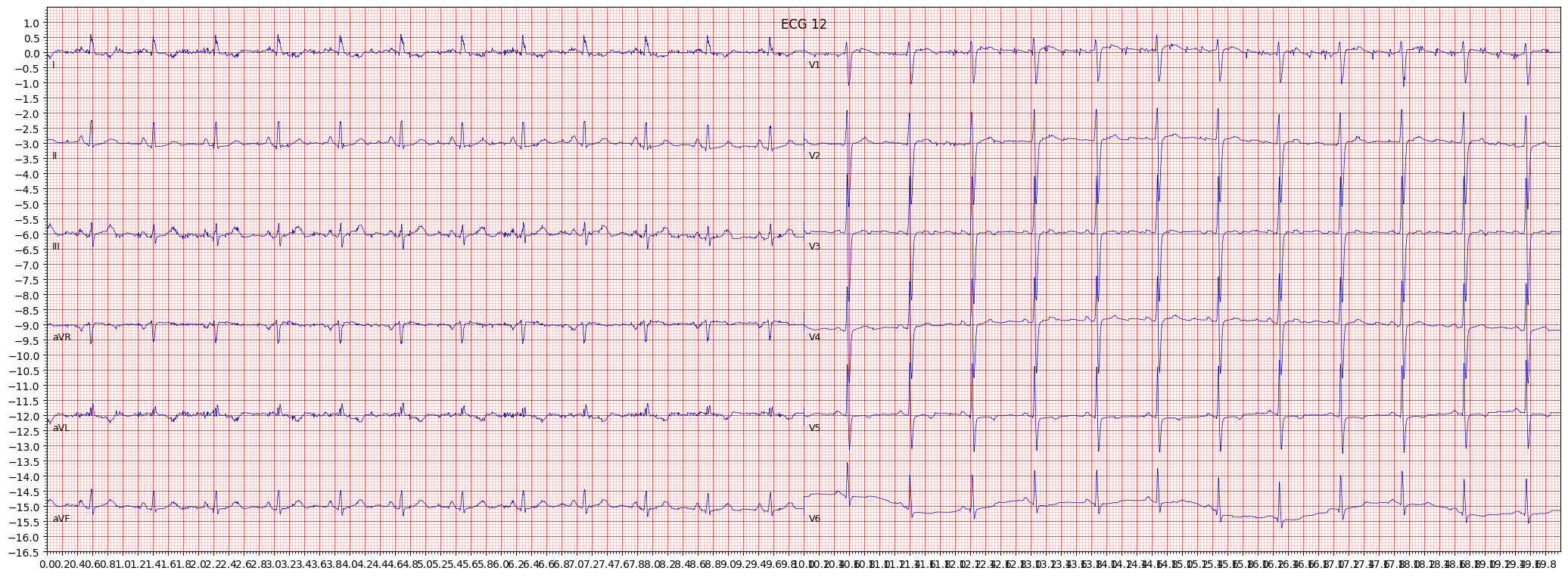 non-specifc ischemic (ISC_) example 1981