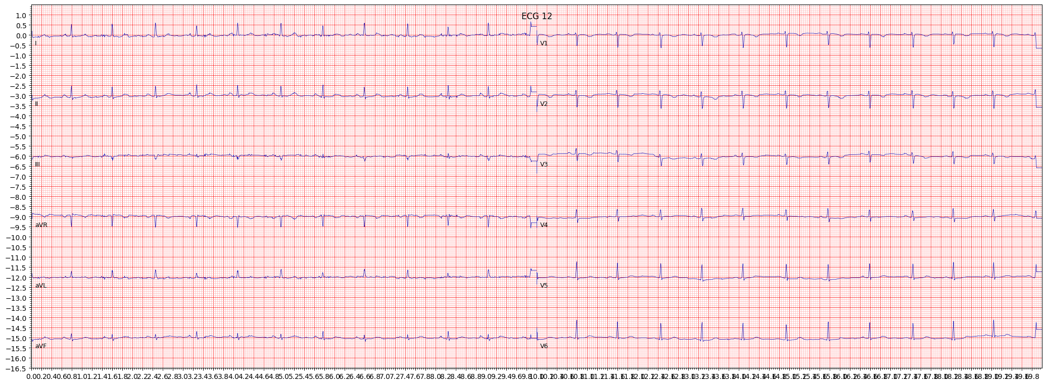 non-specifc ischemic (ISC_) example 2064