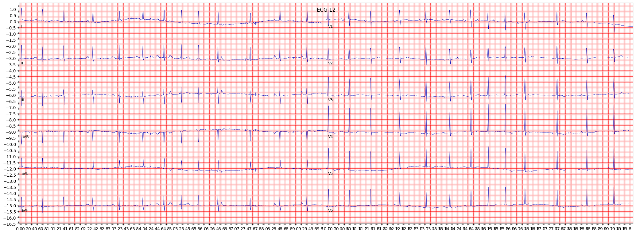 non-specifc ischemic (ISC_) example 2466