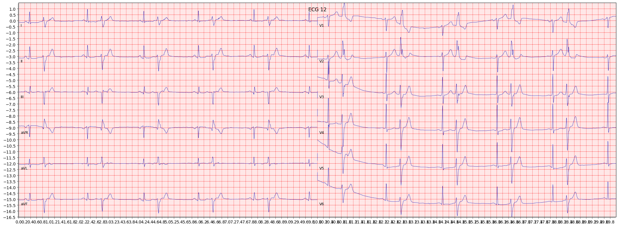 non-specifc ischemic (ISC_) example 4632