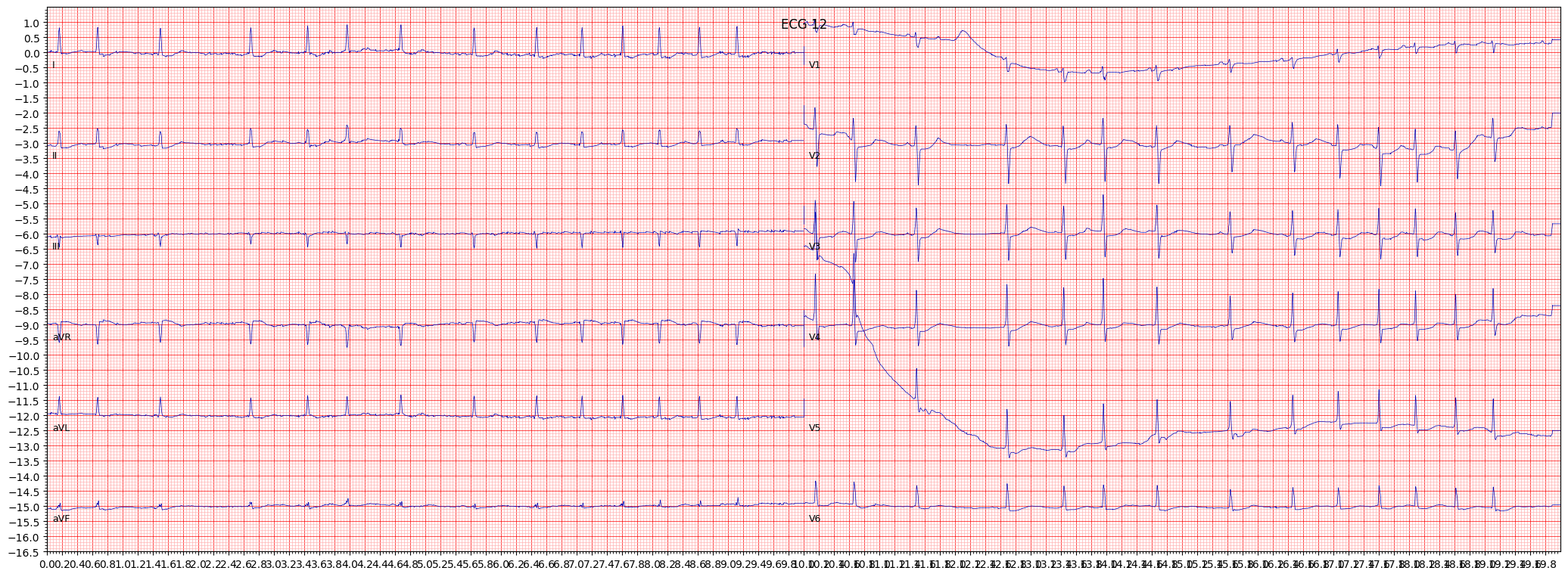 non-specifc ischemic (ISC_) example 757